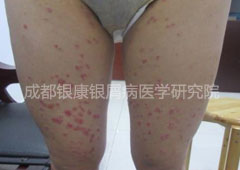 ʳ��������м�� �ٰ㷳��������