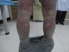 ����ʦ�κ�17����м�缲