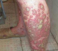 ��м��һȥ������������չ��߷�