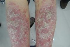 ��м��ʹ�಻�� �����ɷ������