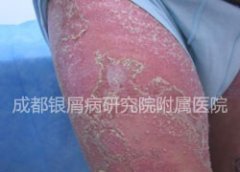 �����ˣ���ţƤ��