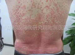 ˦���˹��Ⱥ����βŽ����