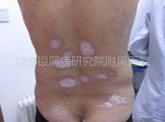 ������������ �����߳���м����Ӱ