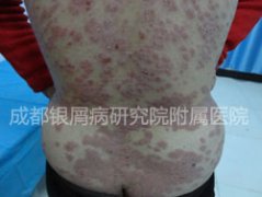 ��м��������ɢ�������ؼ�����