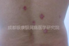 ��һ����ţƤѢ�ĳ־�ս ֻΪ�����˸����õ�δ��