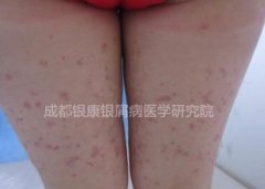 ȫ��Ƥ����м��� �淶���λ�Ƥ������