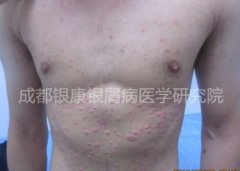 ����м˵�ټ� �ջ��������