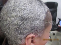 ��ɫ�Ʒ��������������¡�ţƤñ��