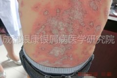 ��ʹ�����¶� Ҳ��Ҫ�������