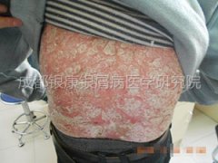 ���˻���м����Ƥ����Ҷ��