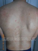 ���Ķ��ף������Ľ���