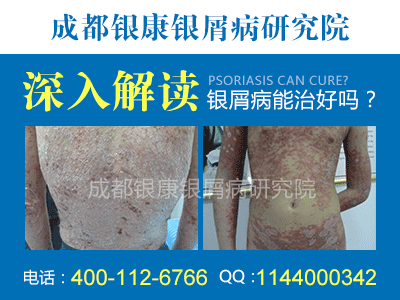 ���淶������δ����м����������?