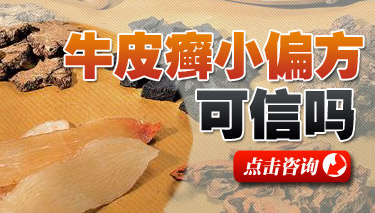 �ҿ�ţƤѢƫ���ļ���ɴ