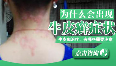 ţƤѢ�ĳ���ԭ������Щ?