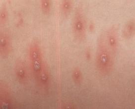 �ҵ�ţƤѢ�Ѿ�14���������